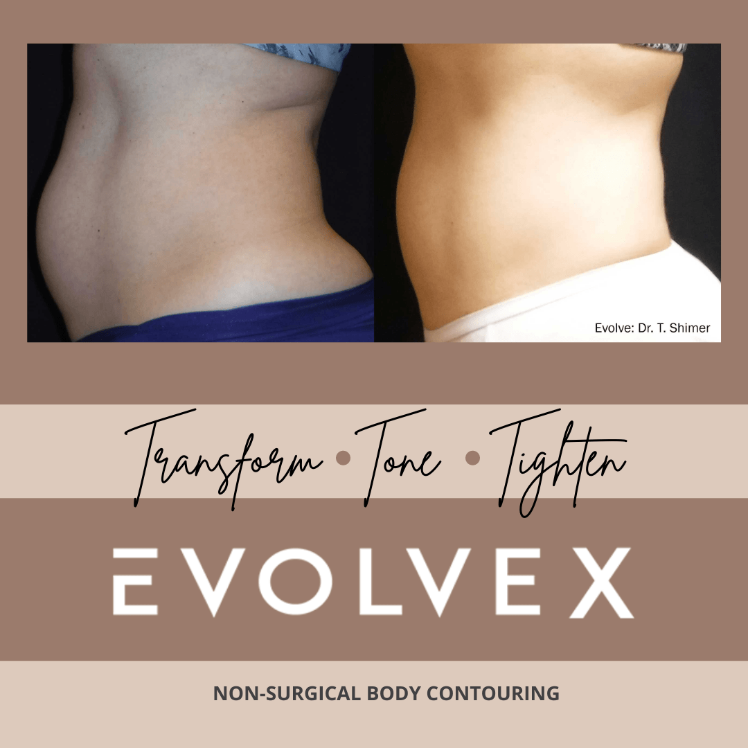 Evolve X transform before and after Stomach