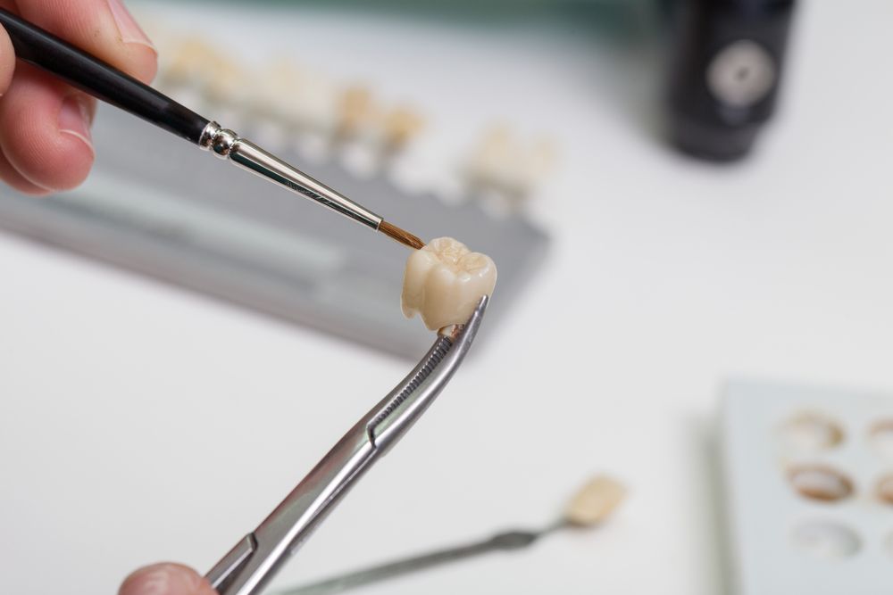 Person painting a dental crown held with tweezers; shade guide in the background.