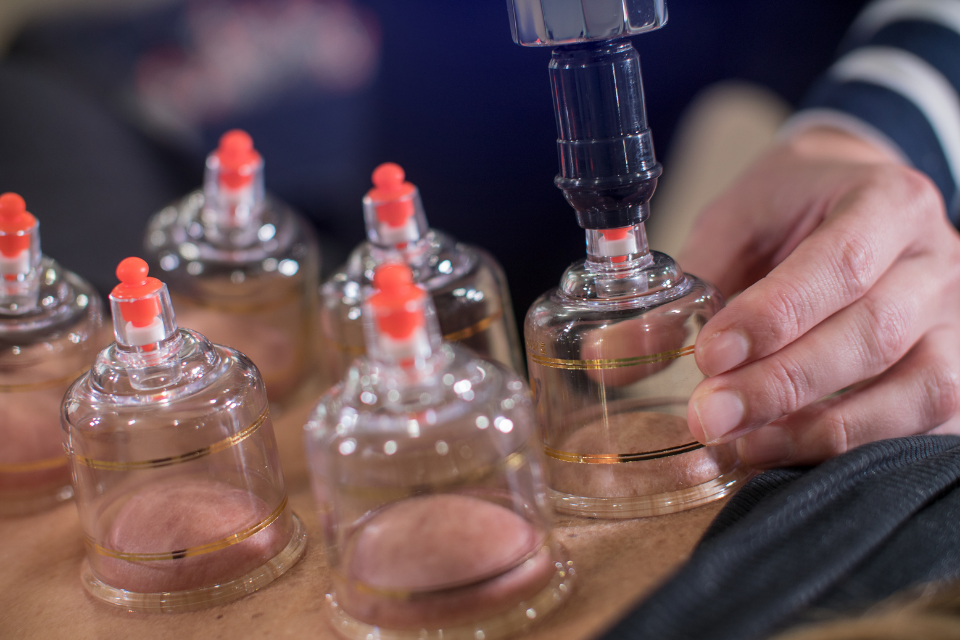cupping therapist