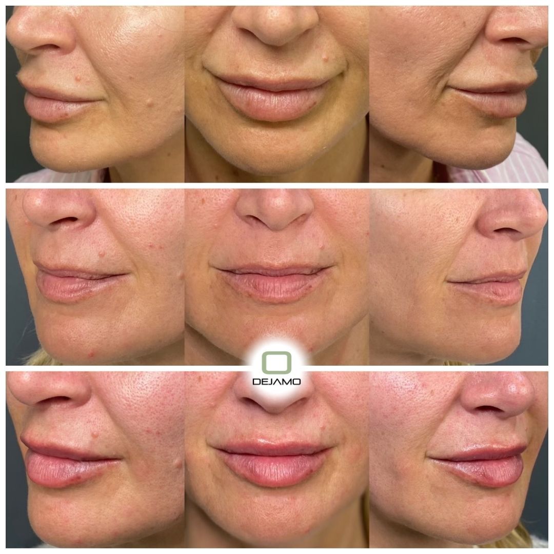 A collage of images of a woman 's face and lips