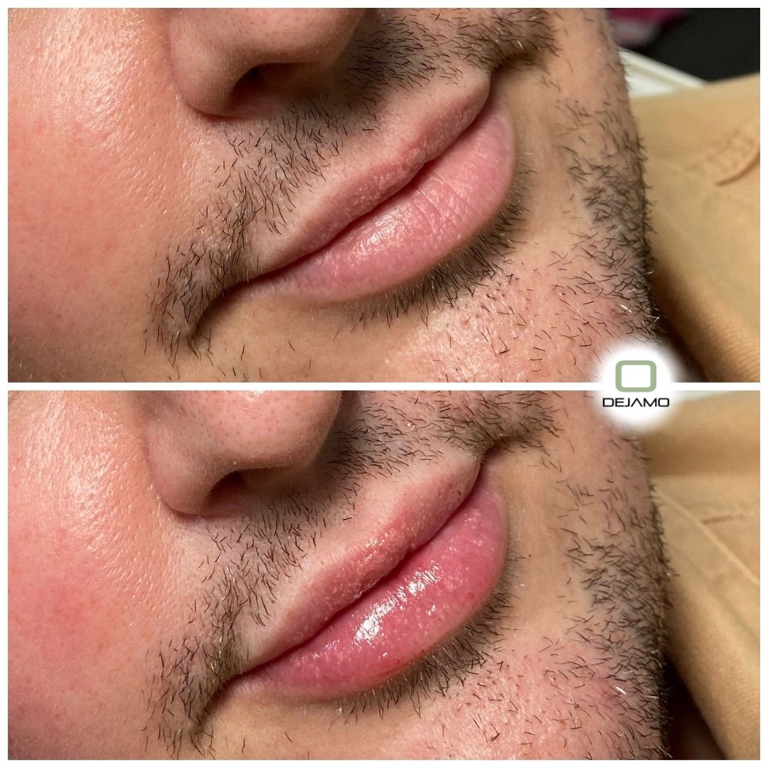 A before and after picture of a man 's lips with a beard.