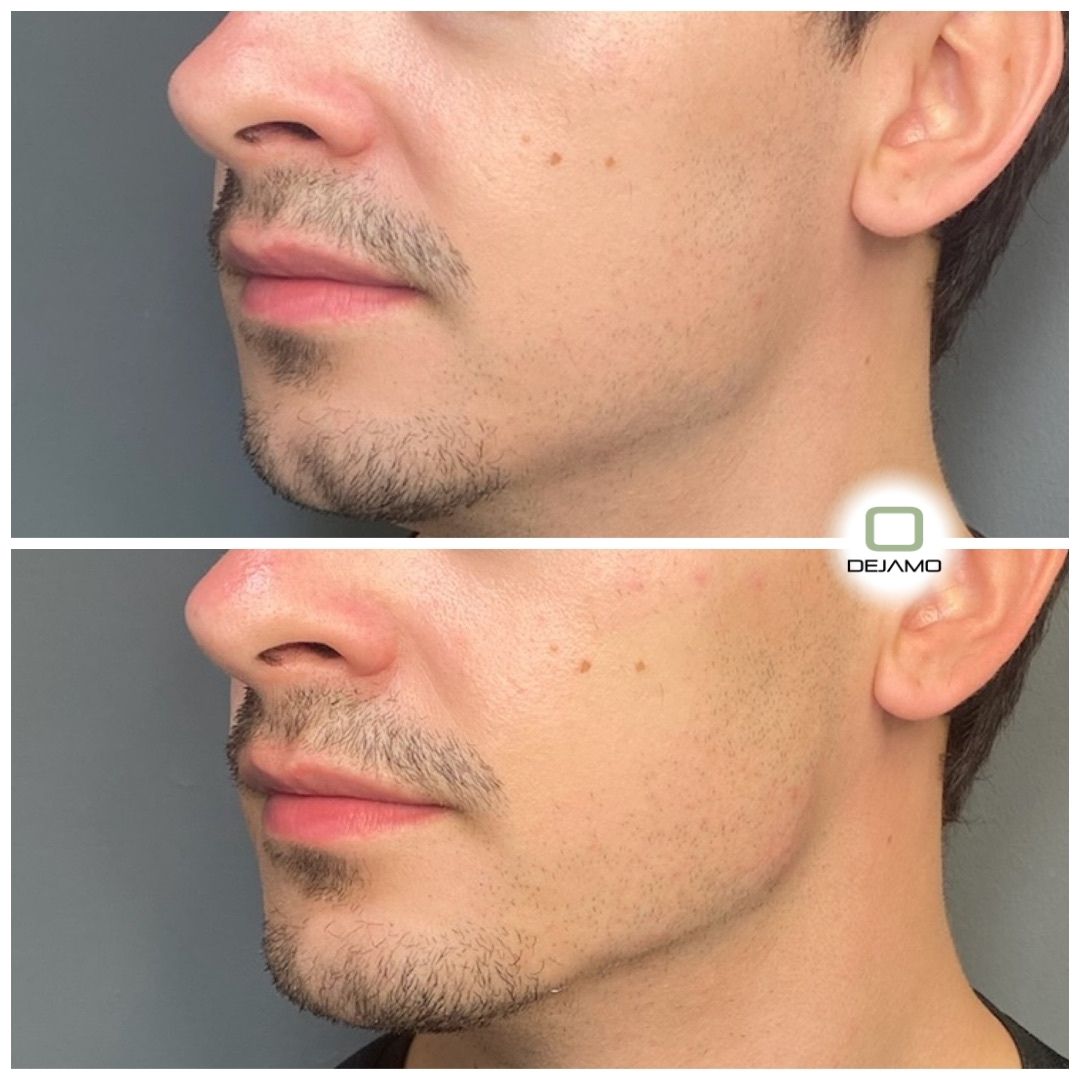 A before and after photo of a man 's face