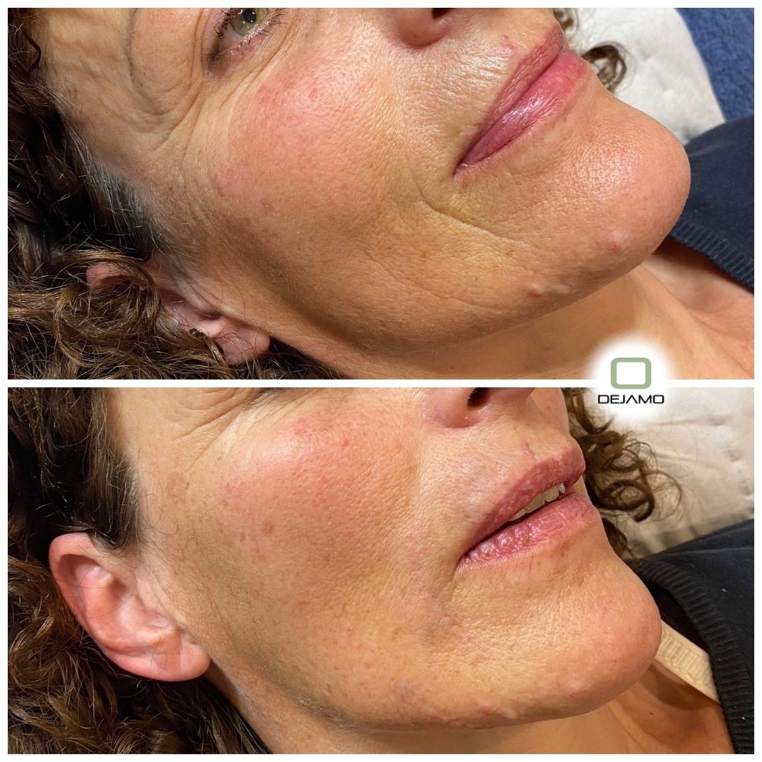 A before and after photo of a woman 's face.