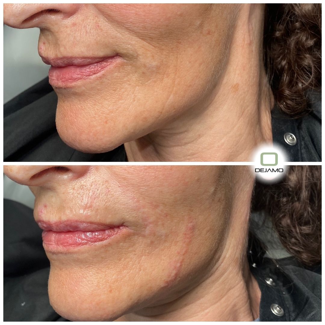 A before and after photo of a woman 's face.