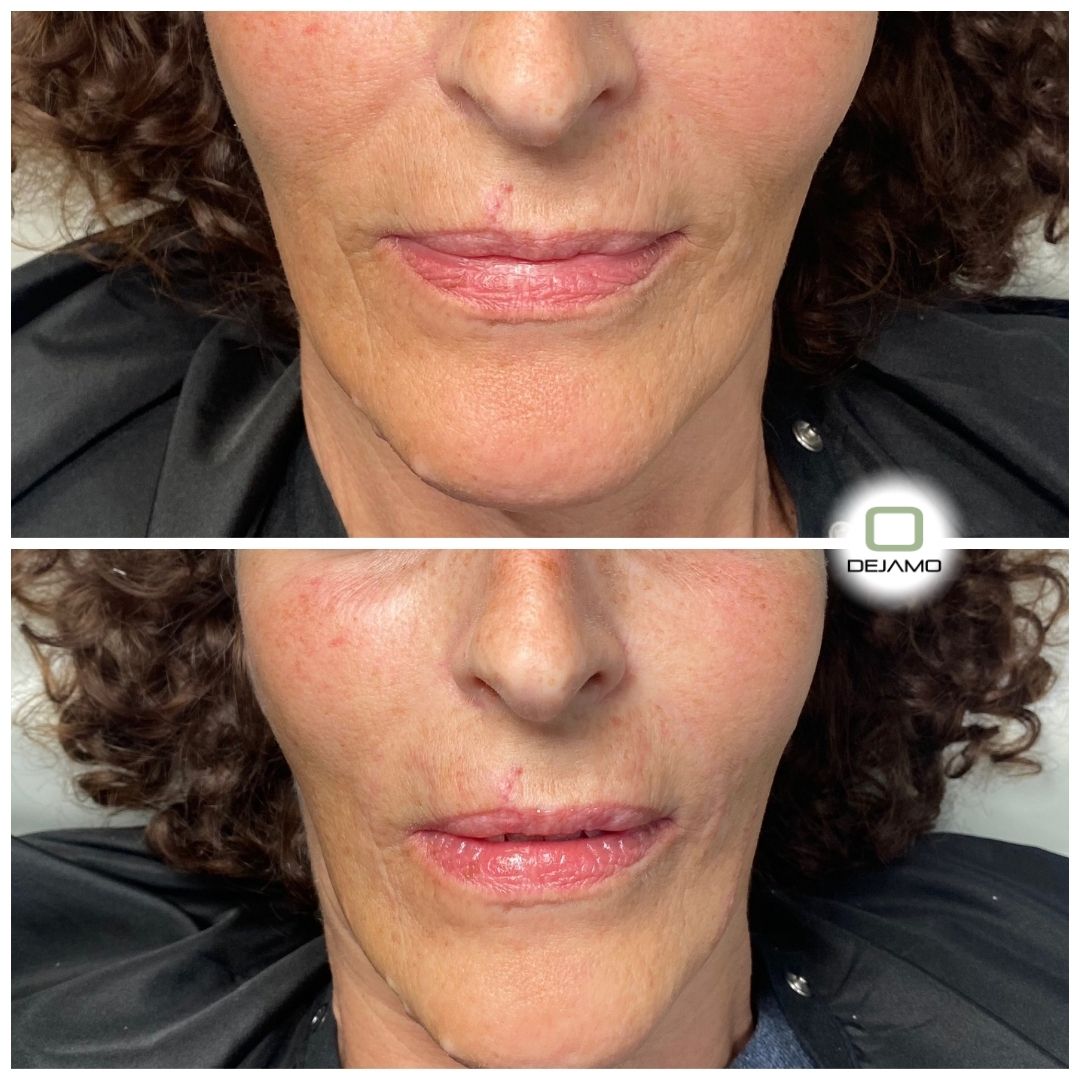 A before and after photo of a woman 's face