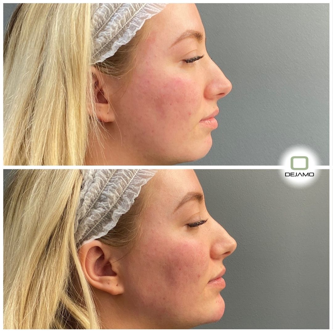 A before and after photo of a woman 's face