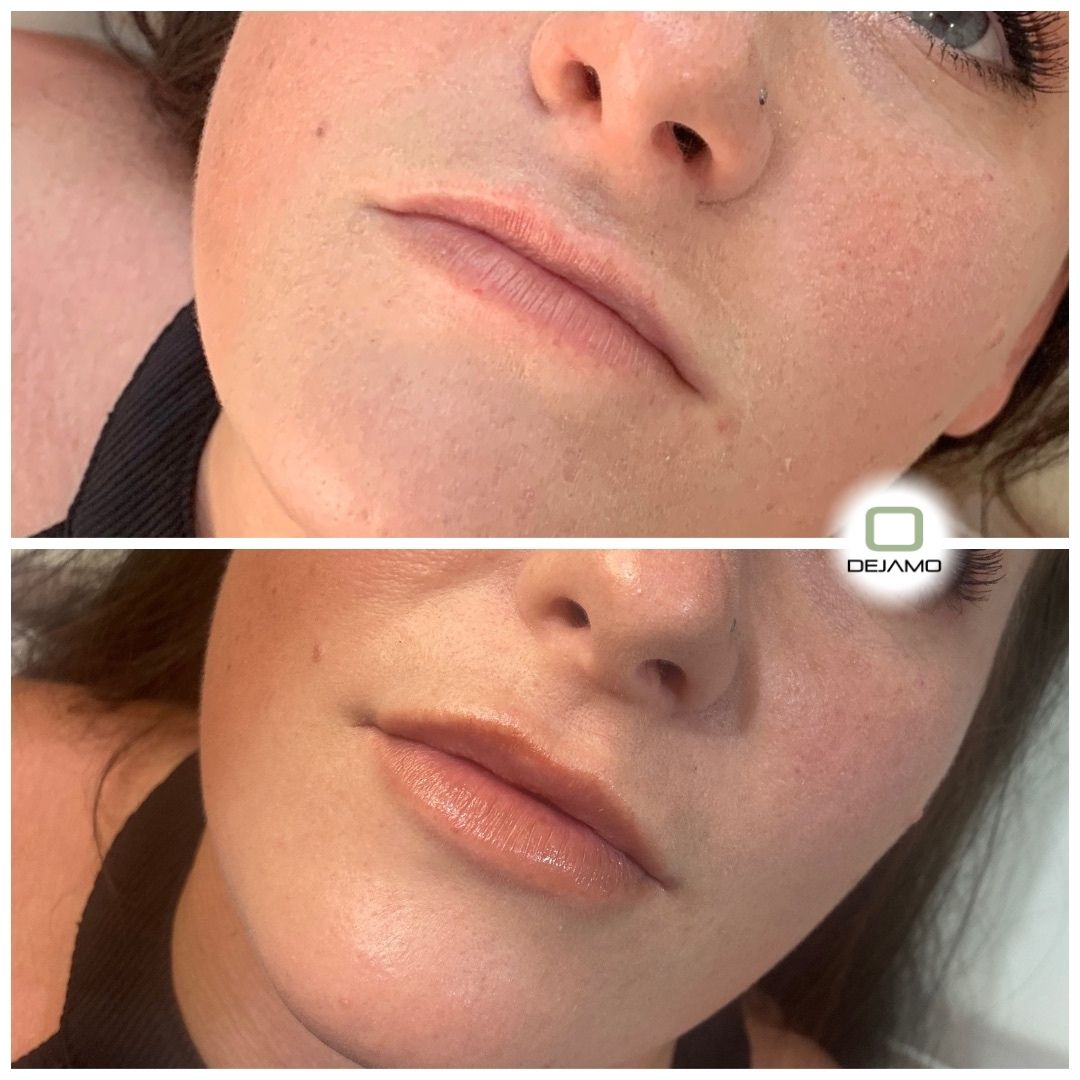 A before and after photo of a woman 's face