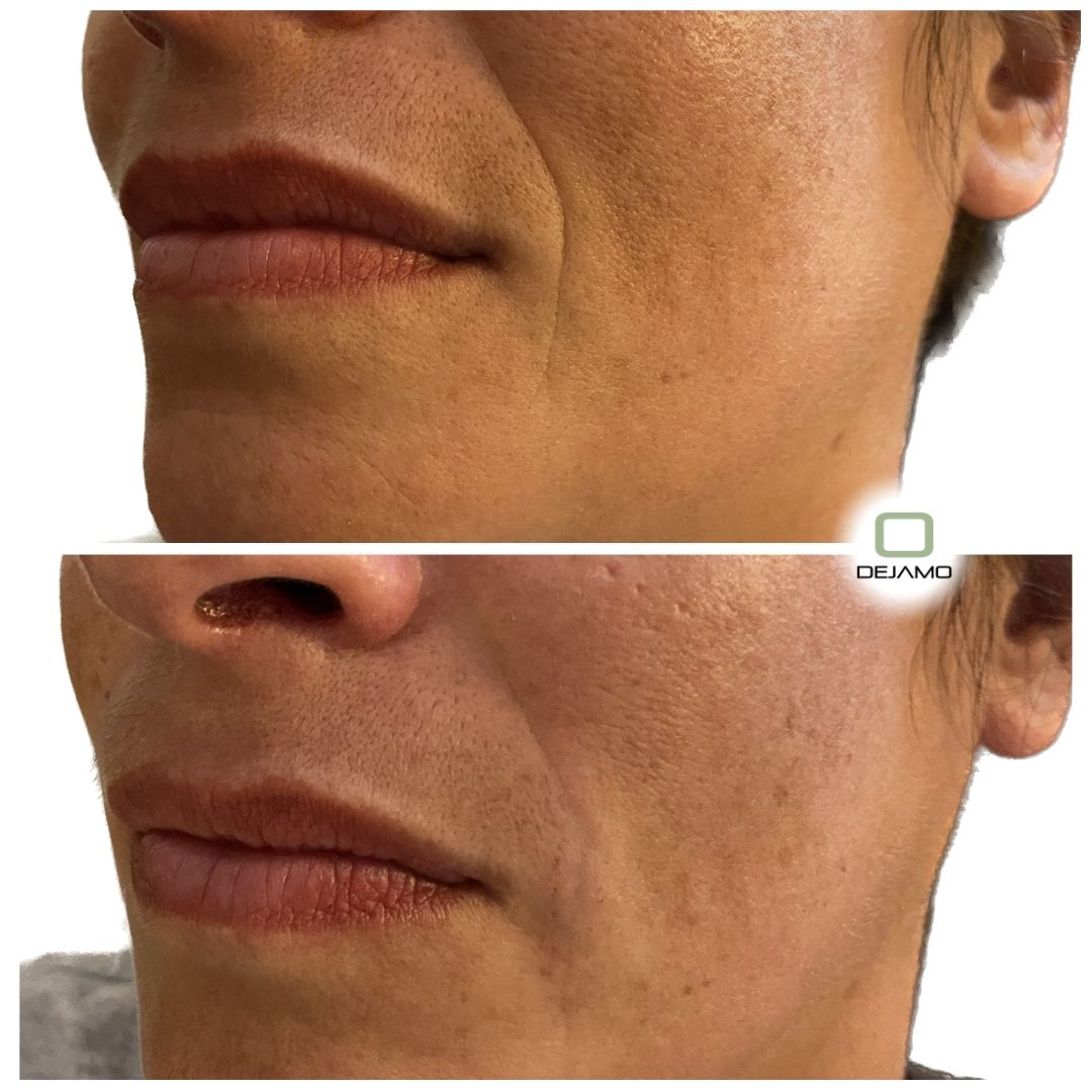 A before and after photo of a woman 's face