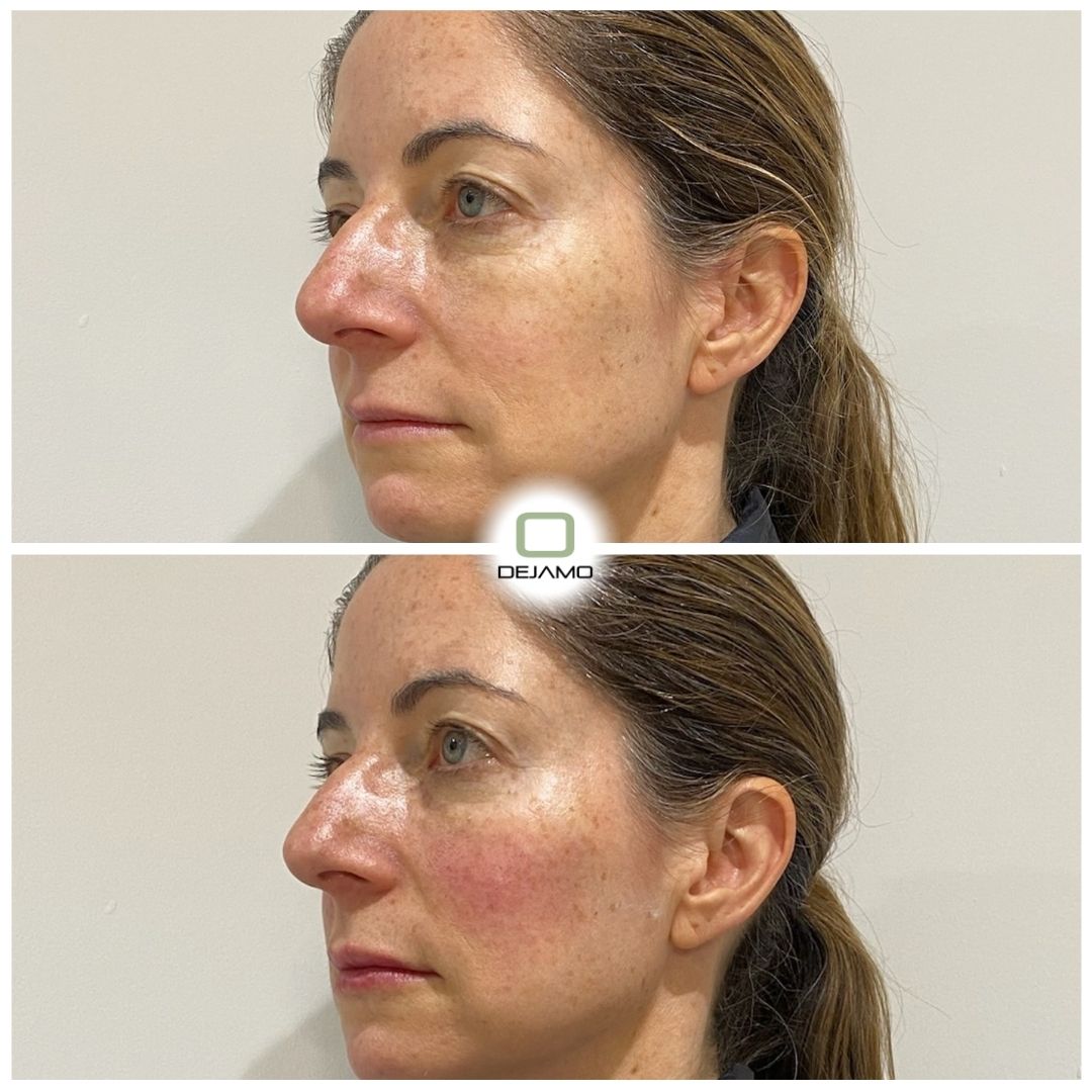 A before and after photo of a woman 's face