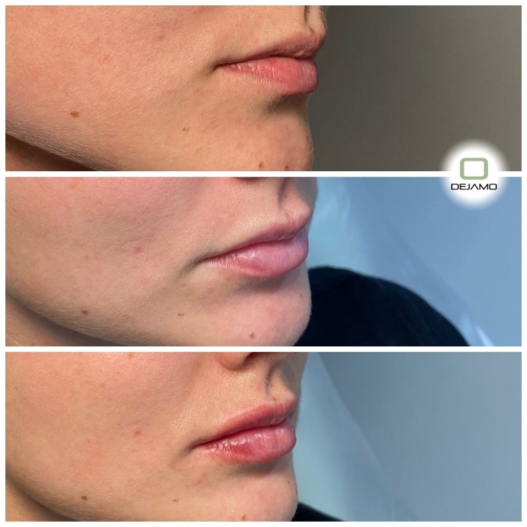 A woman 's lips are shown in three different angles