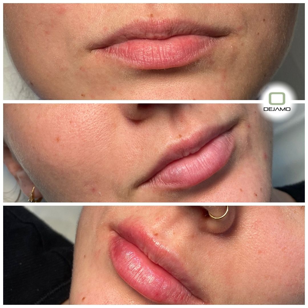 A collage of three pictures of a woman 's lips
