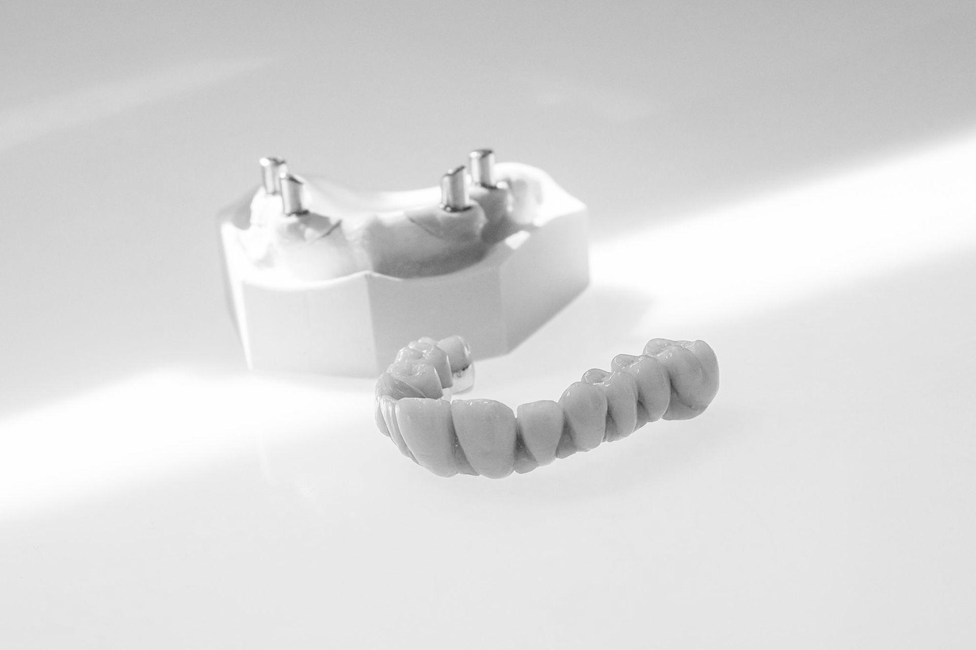 Zahnmodell mit Implantatpfosten und einem Teilzahnbogen.