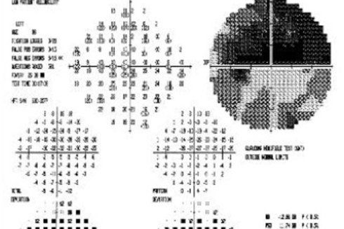 Valutazione salute occhio