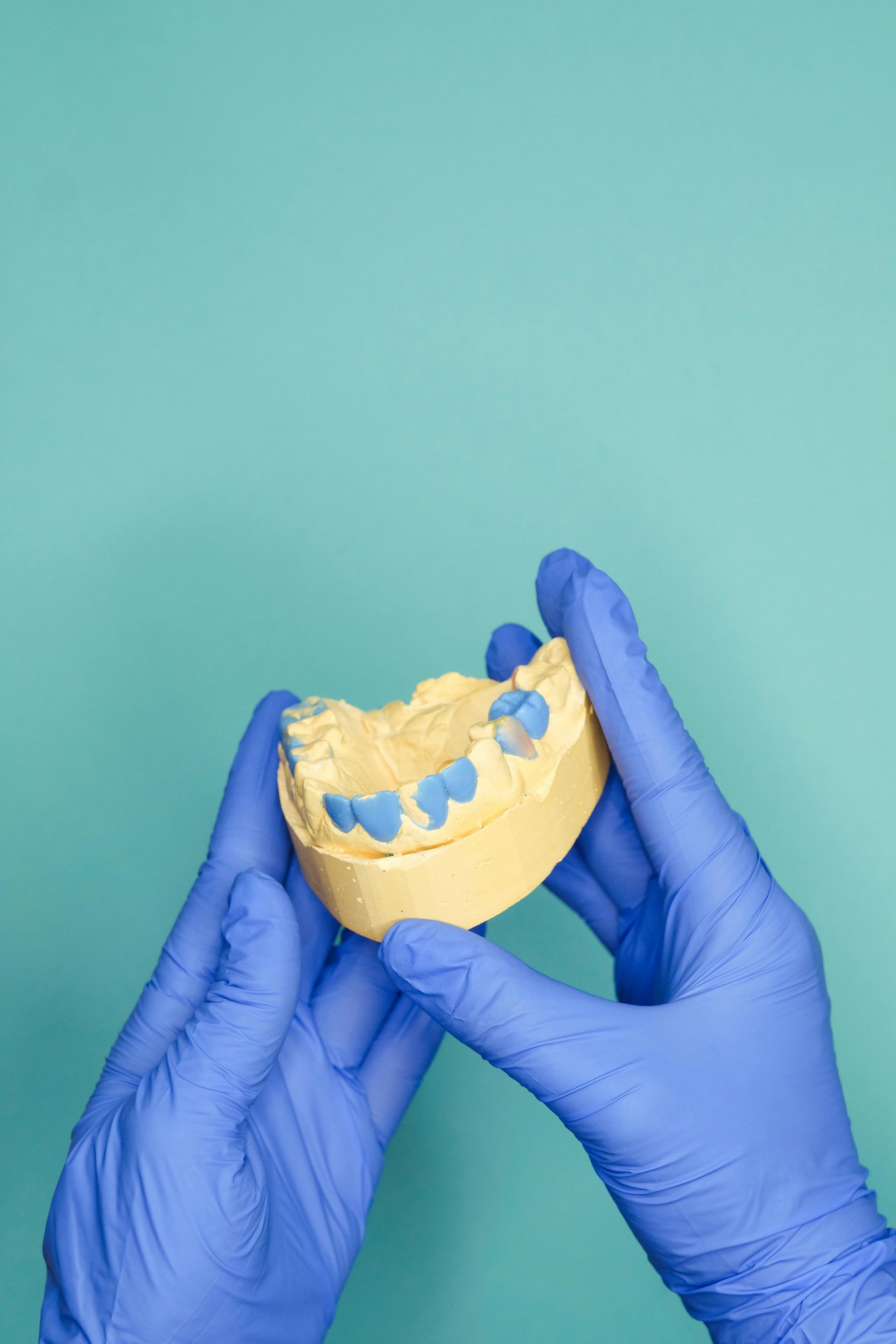 A person wearing blue gloves is holding a model of teeth.