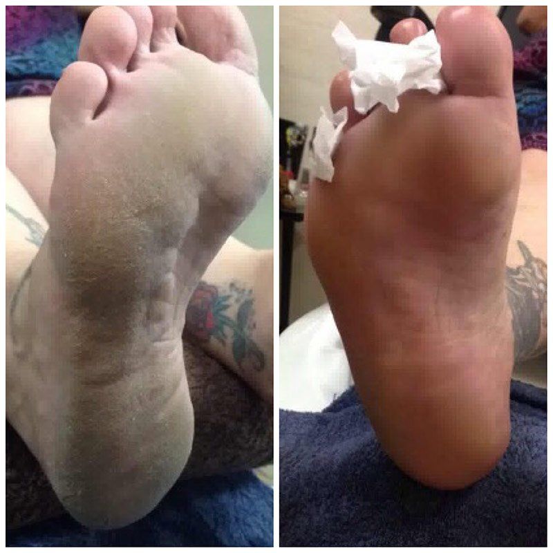 medi pedi before and after