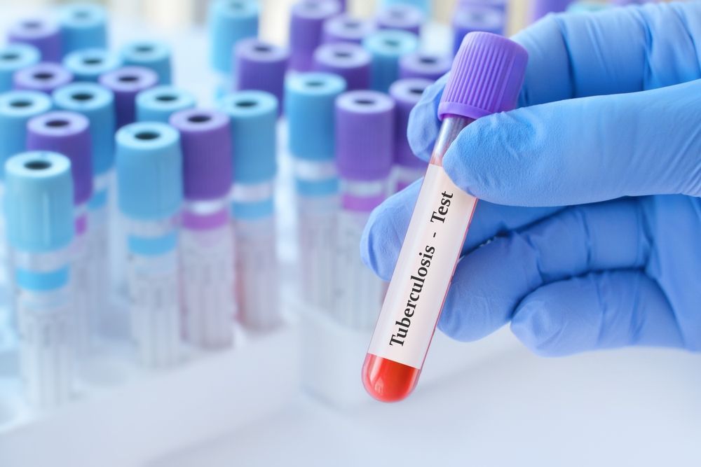Gloved hand holding a blood sample tube in front of rows of purple-capped test tubes