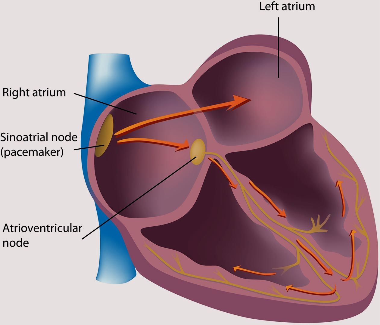 A normal human heart showing the natural pacemaker