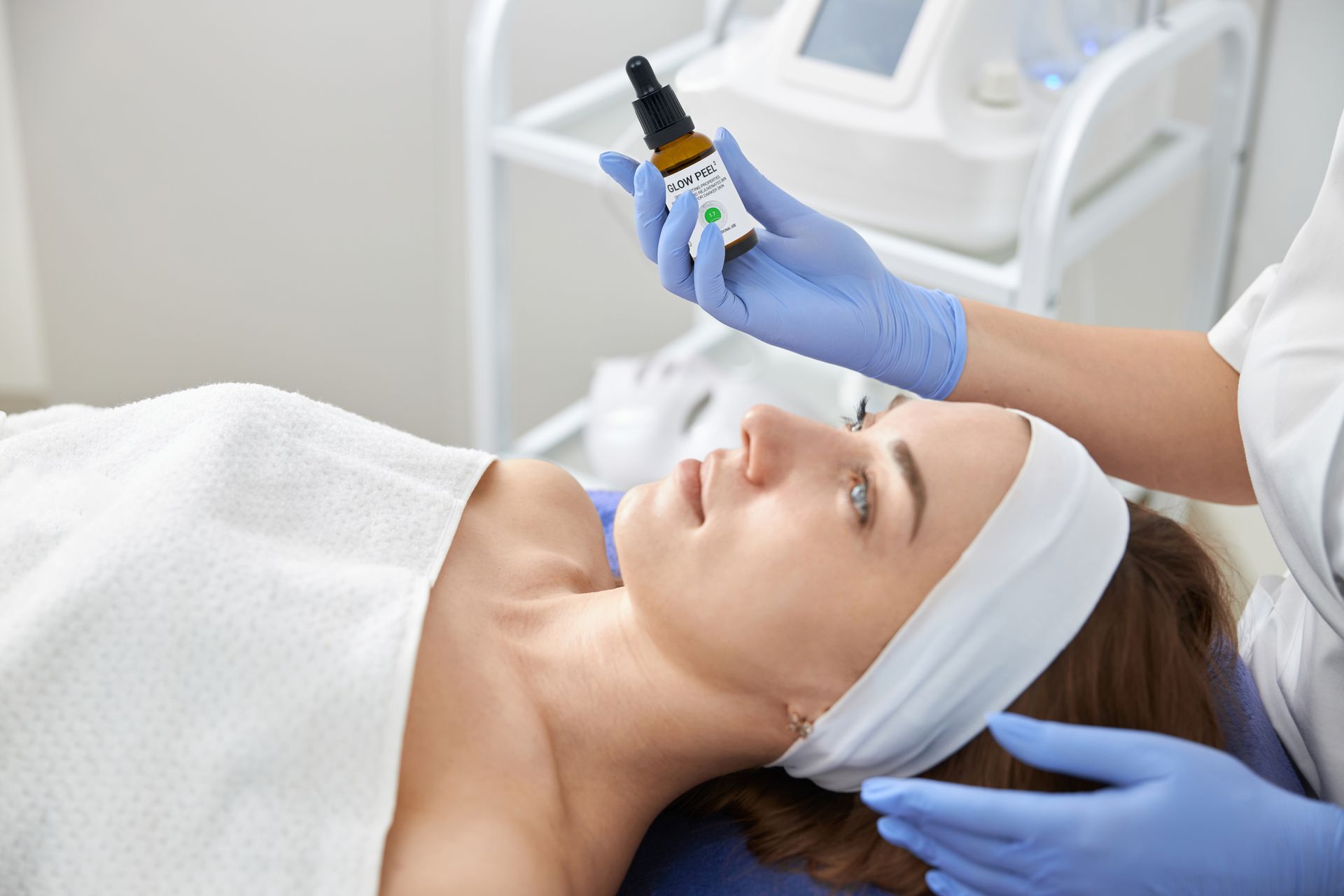    Chemical peel for pigmentation Bristol