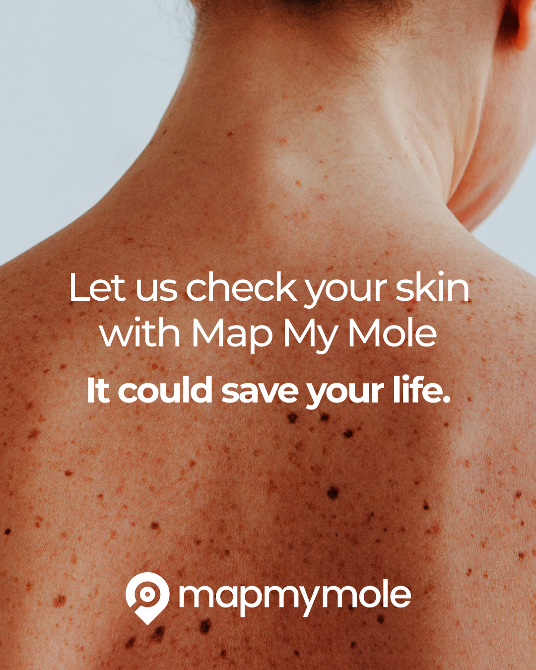 Map My Mole skin lesion screening at Jax-Glam Beauty Bristol
