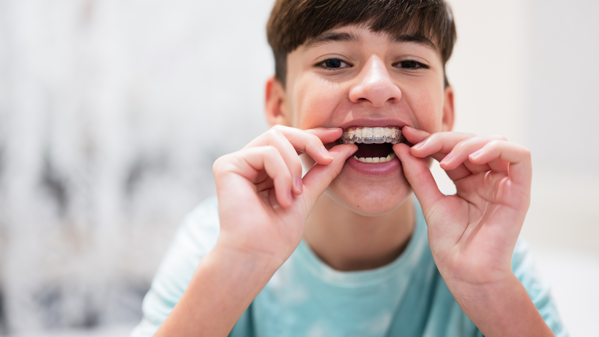 A young boy is putting braces on his teeth.
