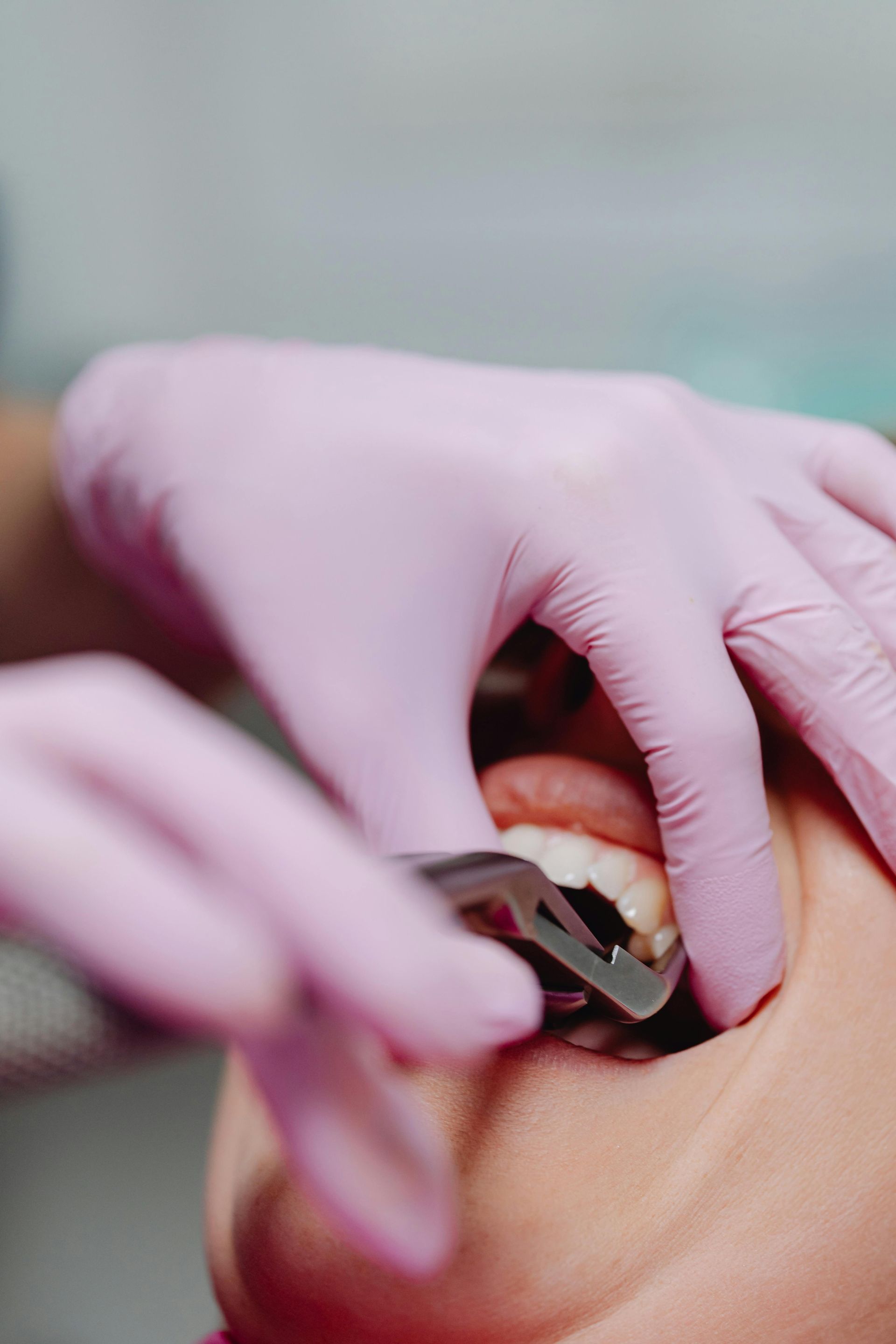 A woman is getting her teeth examined by a dentist wearing pink gloves.