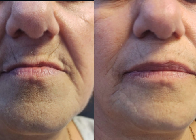 Armonía facial y labial 