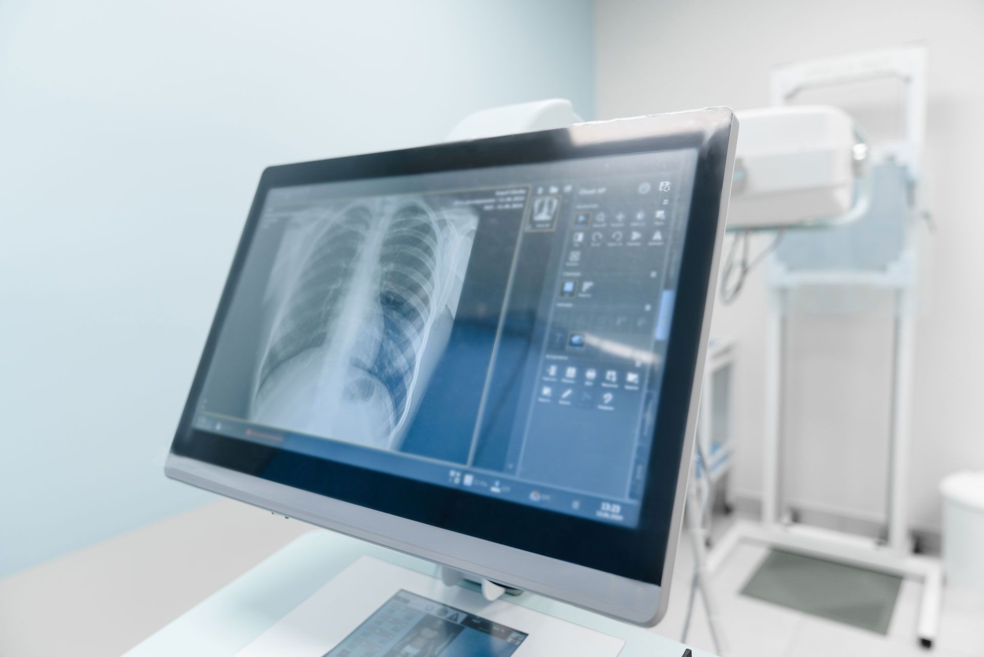 X-ray monitor displaying a chest image, medical equipment visible in a pale blue room.