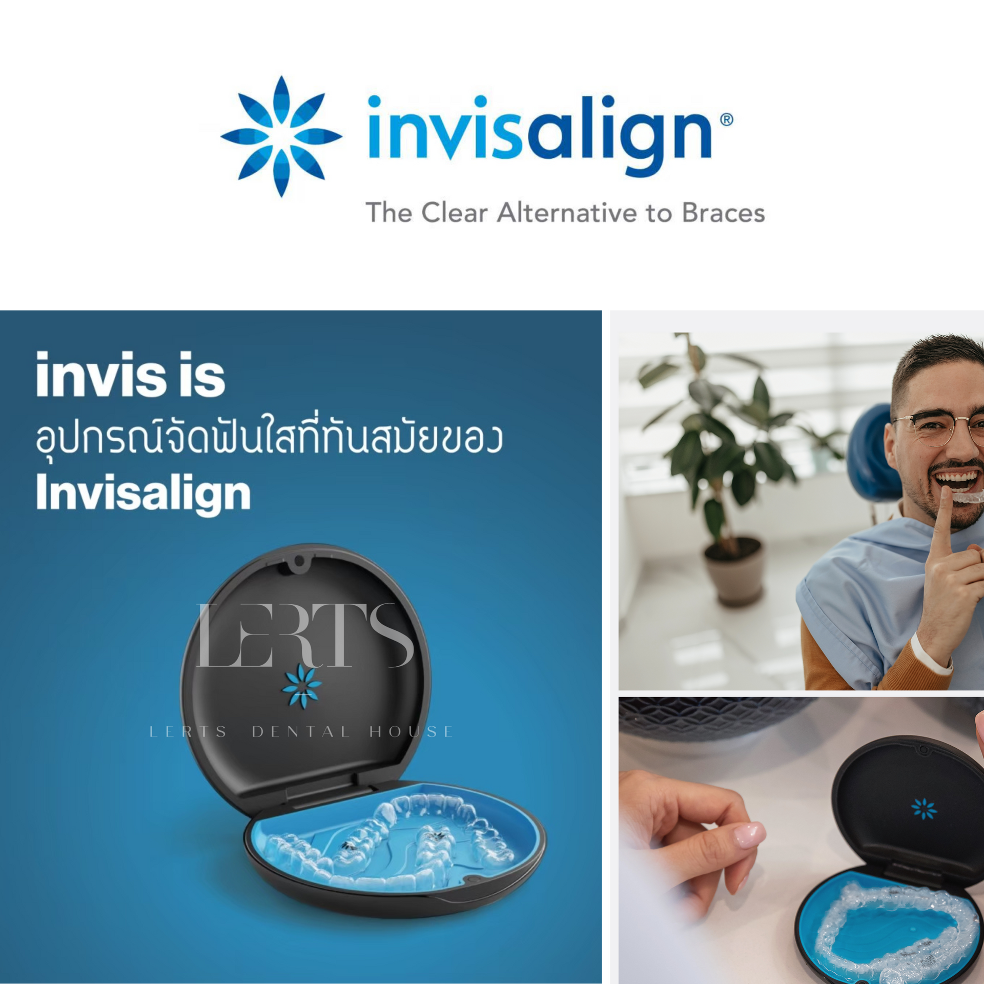 Advertisement for Invisalign. Product case open, clear aligners visible. Person putting aligner in mouth, smiling.