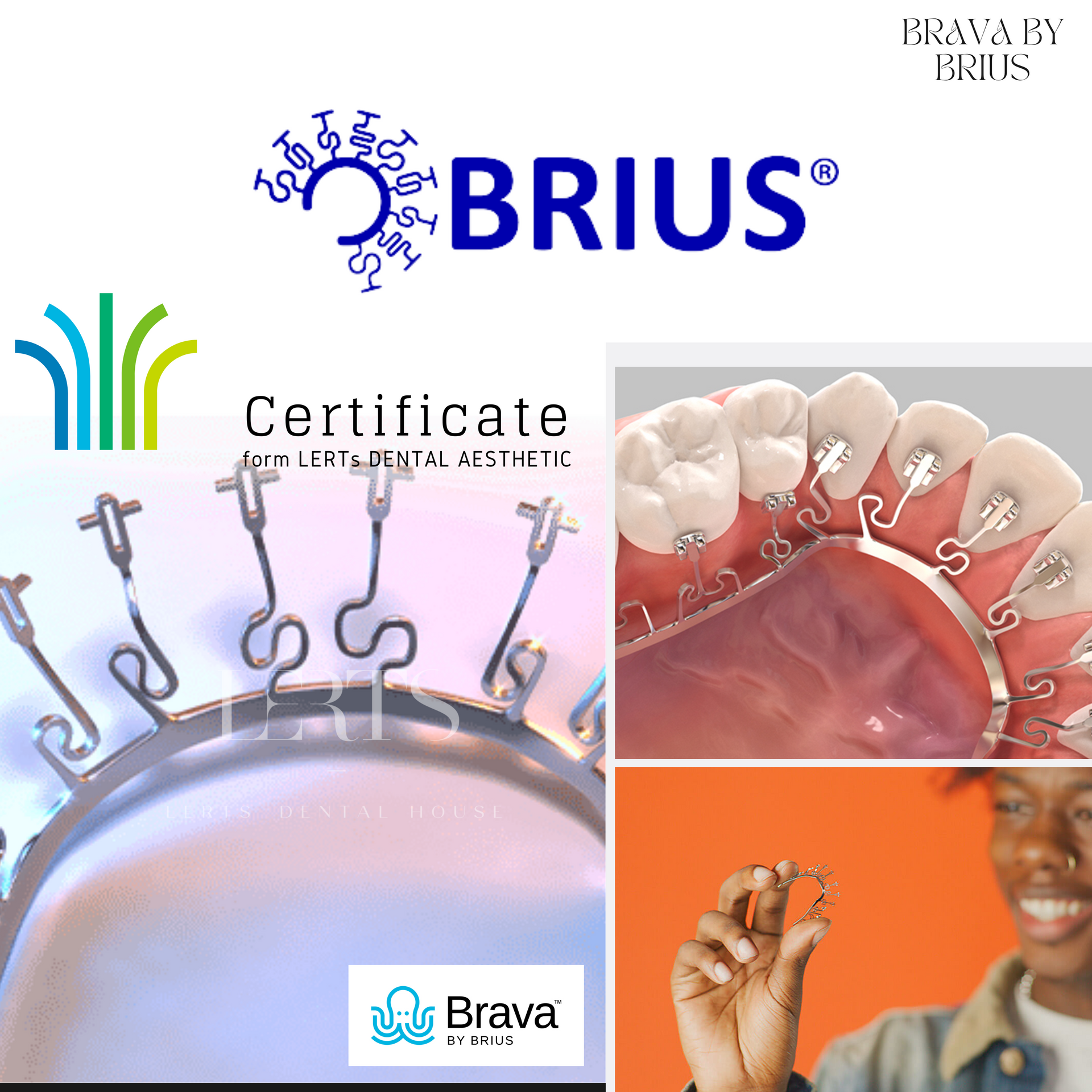 Logos and images of Brius braces: a dental treatment using small, flexible wires to straighten teeth.