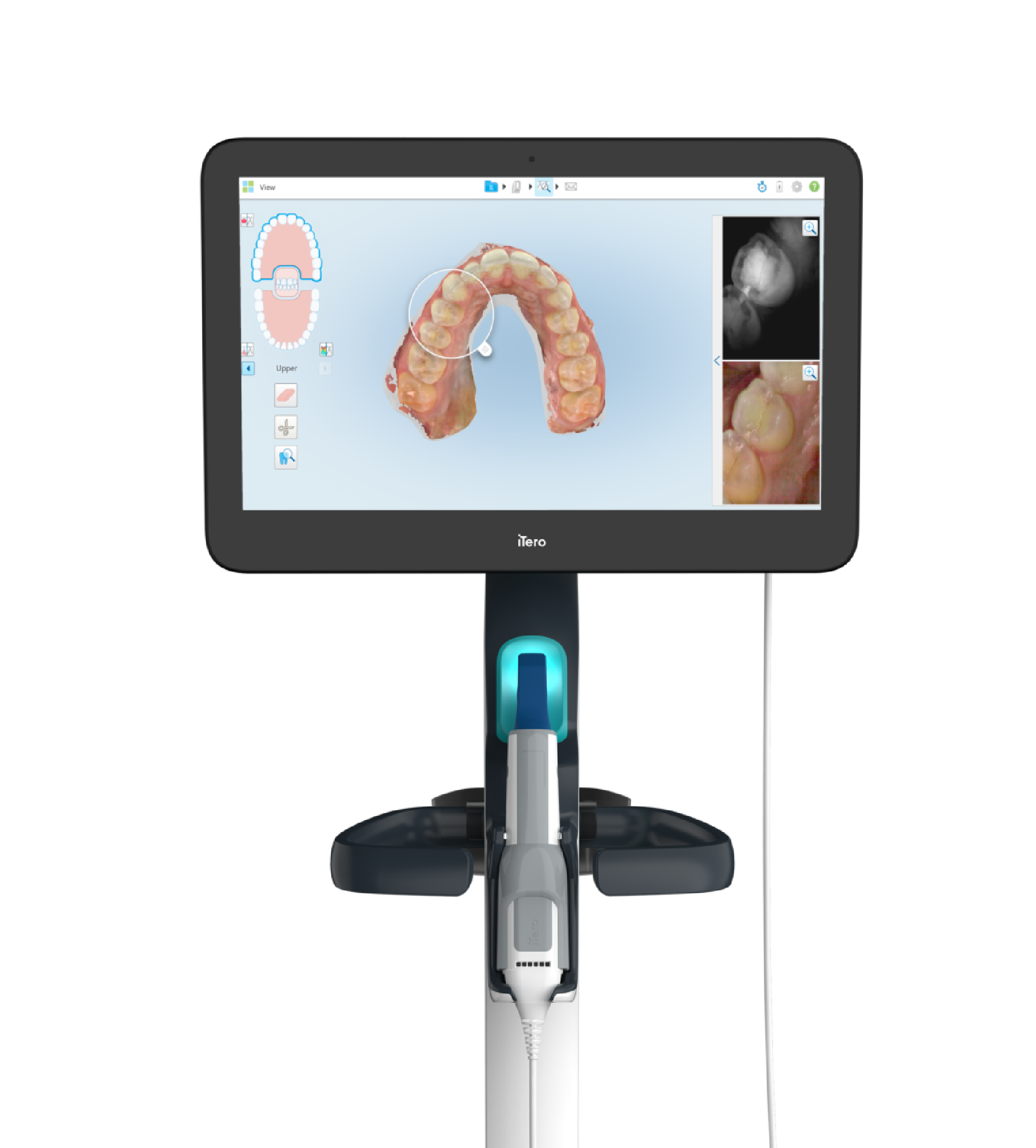 Itero Oral scanner