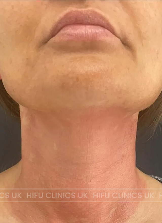 A close up of a woman 's face and neck with earrings.