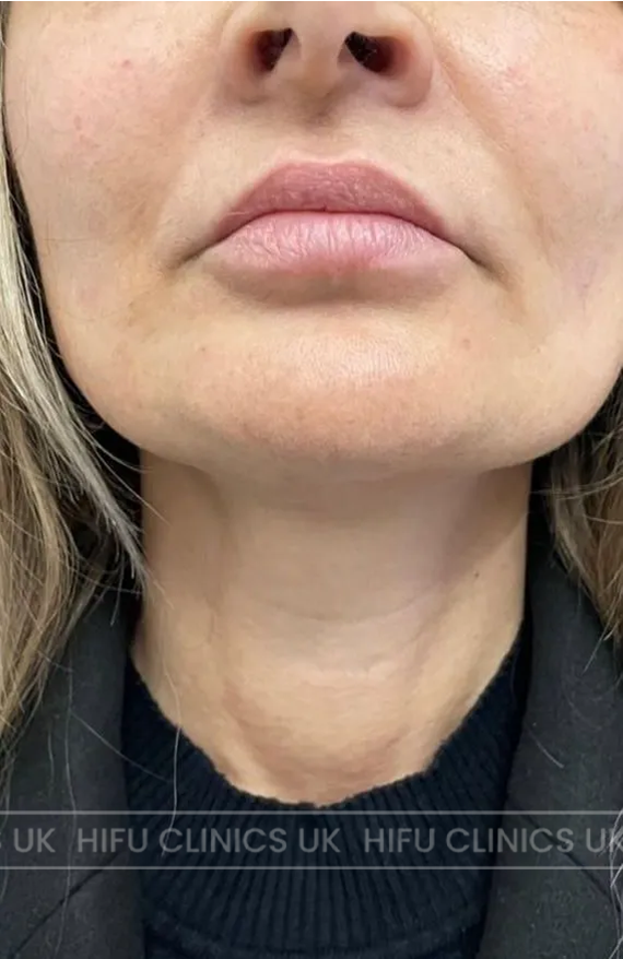 A close up of a woman 's face and neck with earrings.