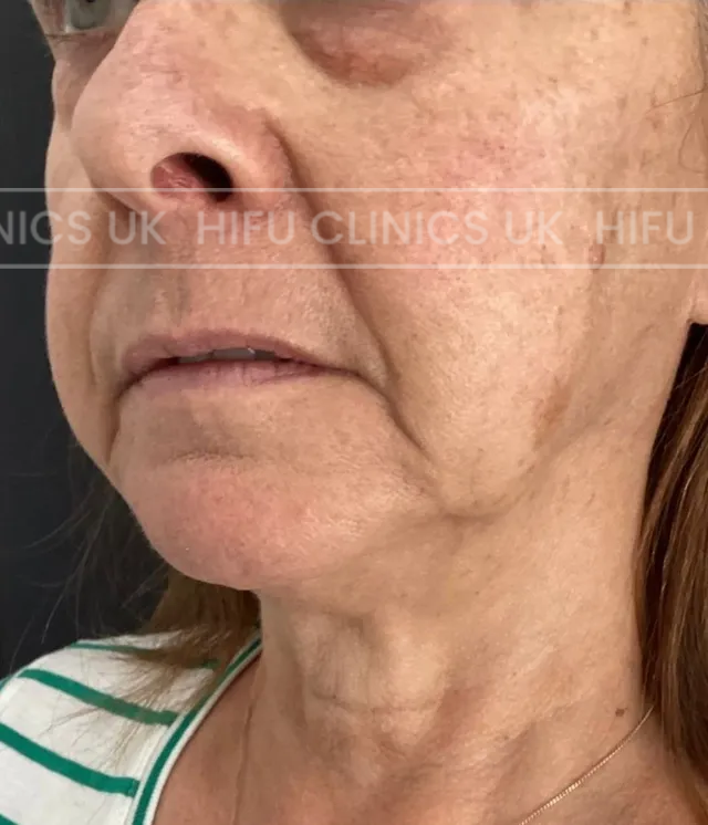 A close up of a woman 's face and neck.