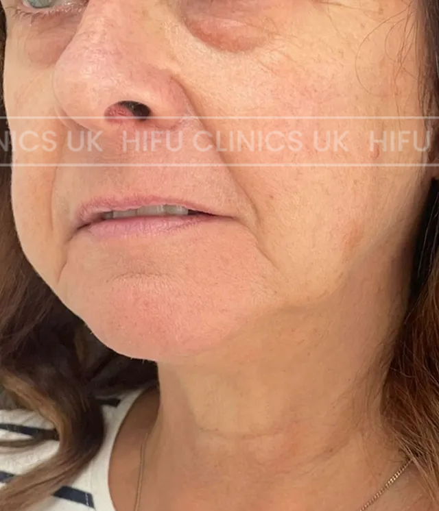 A close up of a woman 's face and neck.