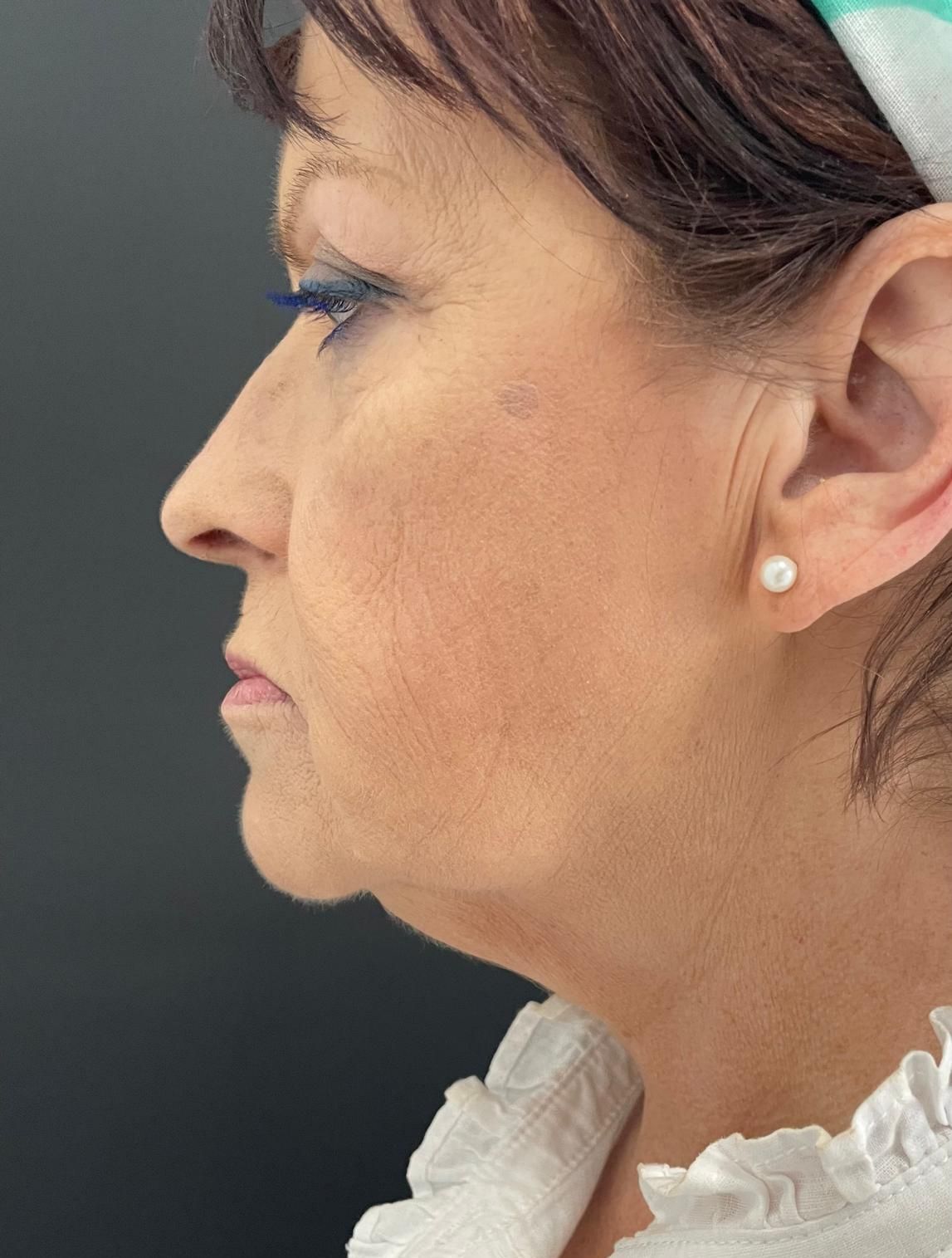 A close up of a woman 's face and neck with earrings.