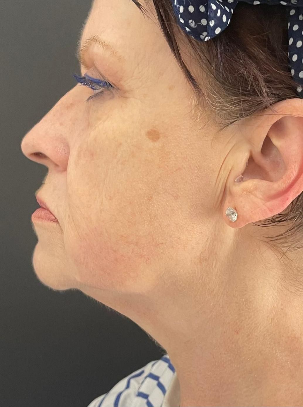 A close up of a woman 's face and neck with earrings.