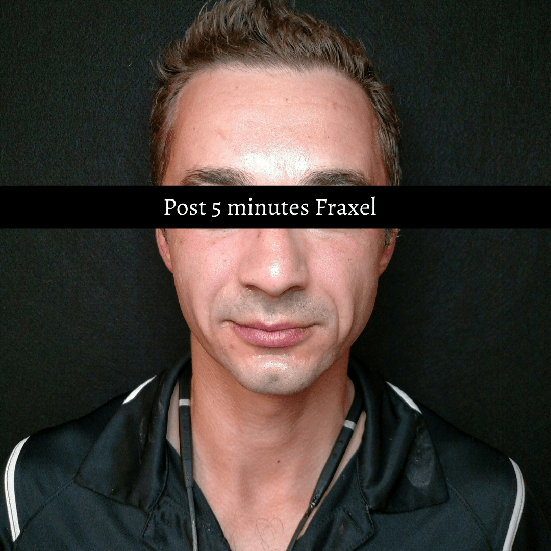 A man with the words post 5 minutes praxel on his face