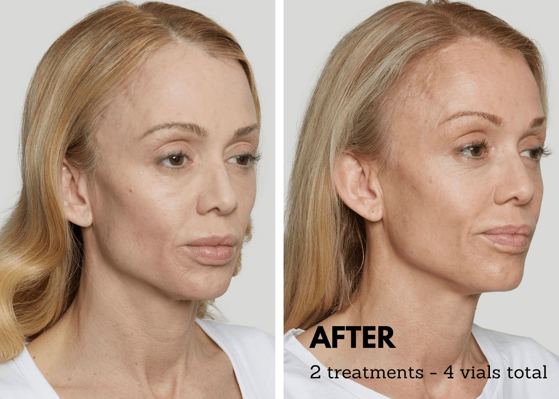 A before and after photo of a woman 's face