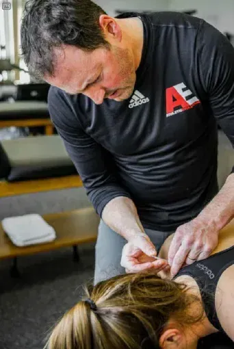 A man is giving a woman acupuncture in a gym.