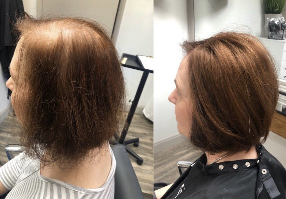 Woman with Her Lost Hair Procedure — Greenville, SC — Artistic Cutters Salon & Day Spa