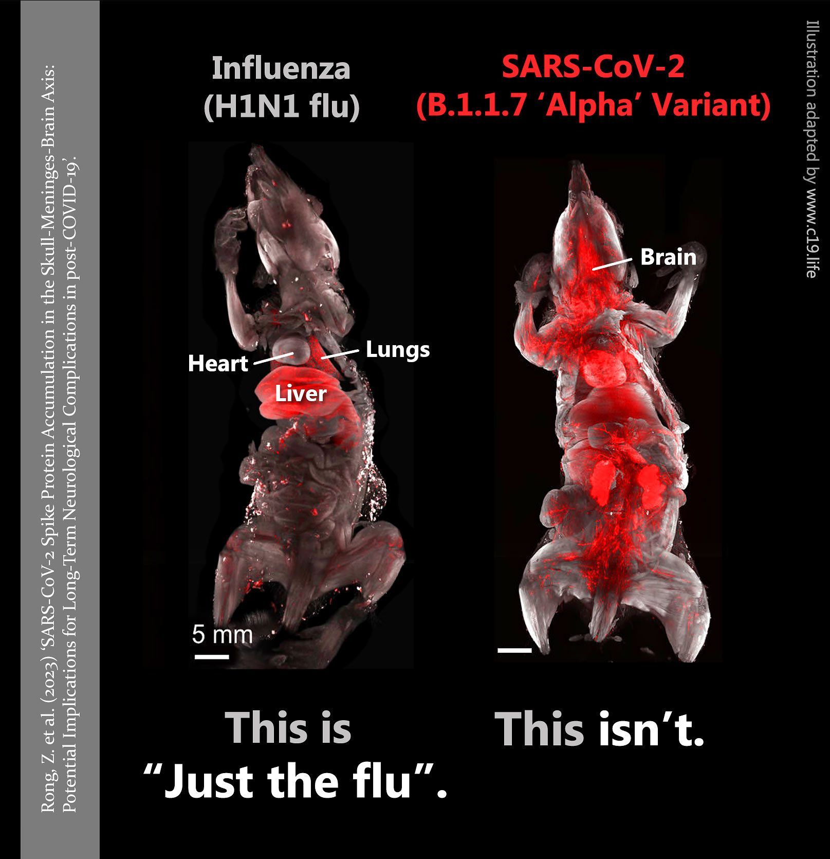 SARS-CoV-2 Spike Protein Accumulation in the Skull-Meninges-Brain Axis: Potential Implications for Long-Term Neurological Complications in post-COVID-19.