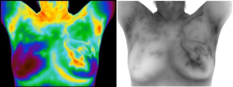 A side-by-side comparison of a colored thermogram and a grayscale image of a person's chest.