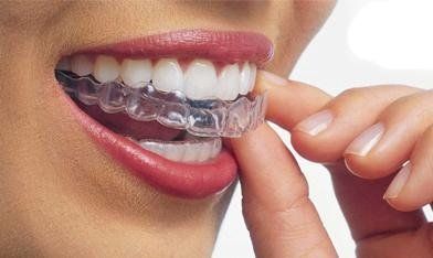 Bite dentale