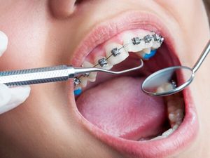 Visita ortodontica