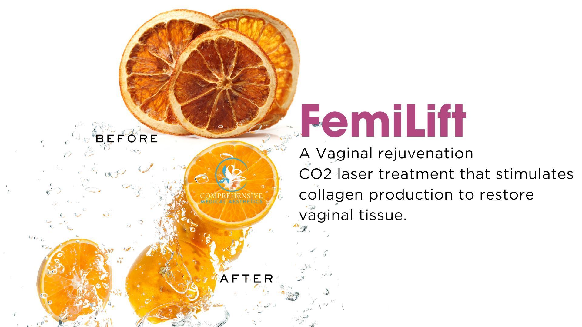 FemiLift advertisement: orange slices labeled