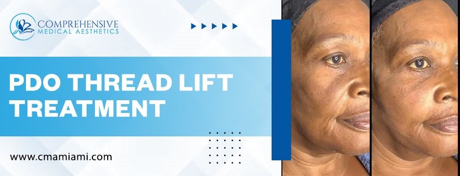 PDO Thread Lift Treatment