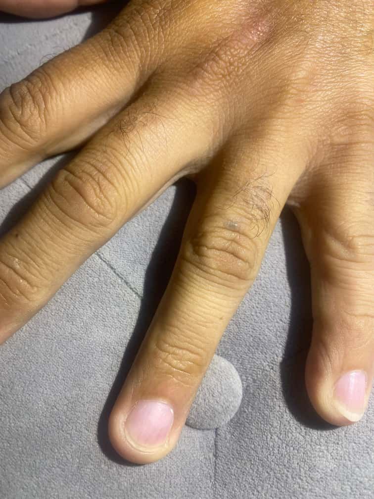 Hand resting on a gray surface, fingers slightly bent, showing skin texture and nails.