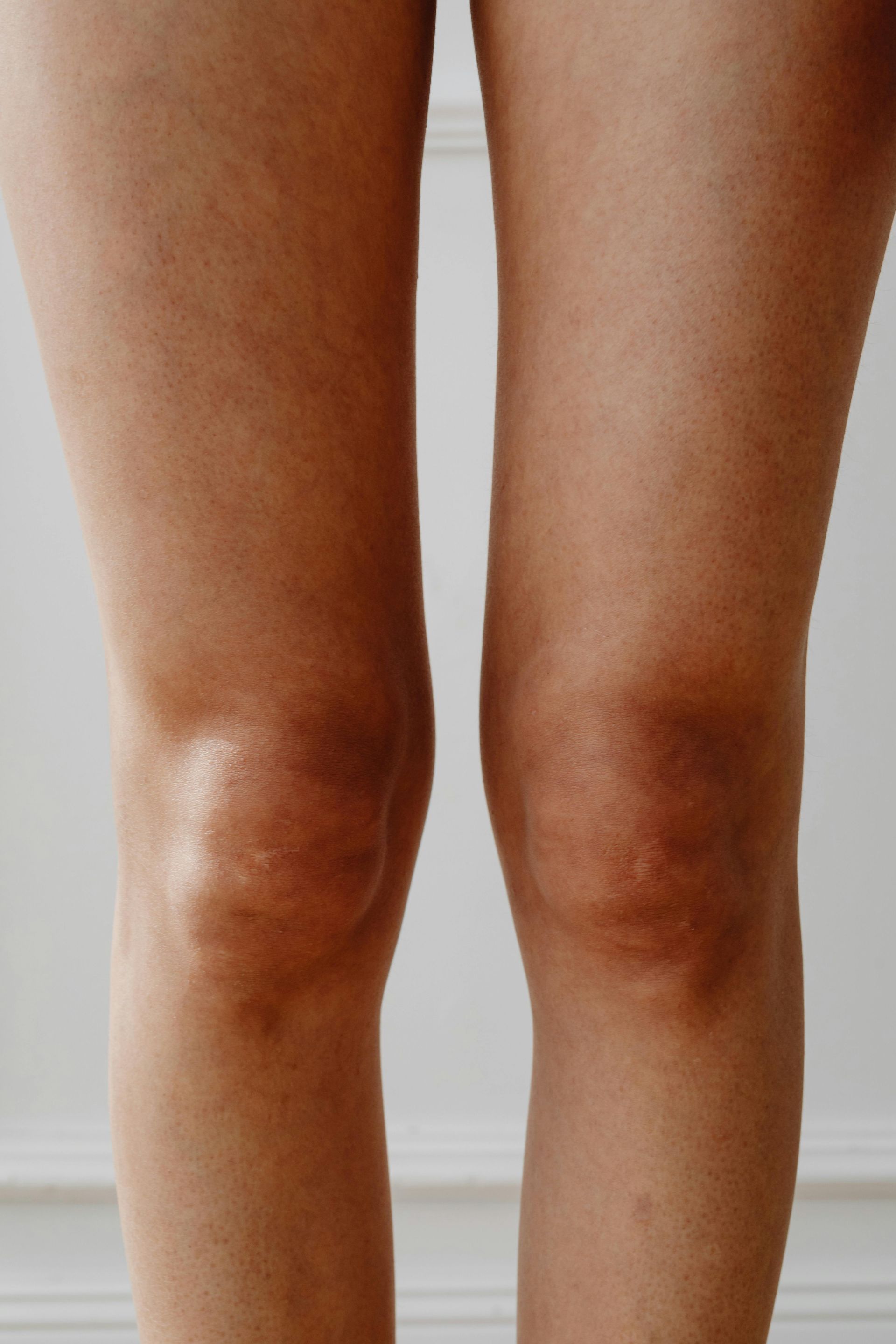 Two human legs, knees visible, with slightly darker skin around the knee joints.