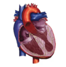 Diagram of heart with  Mid-Cavity HCM

