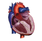 Diagram of HCM heart without obstruction